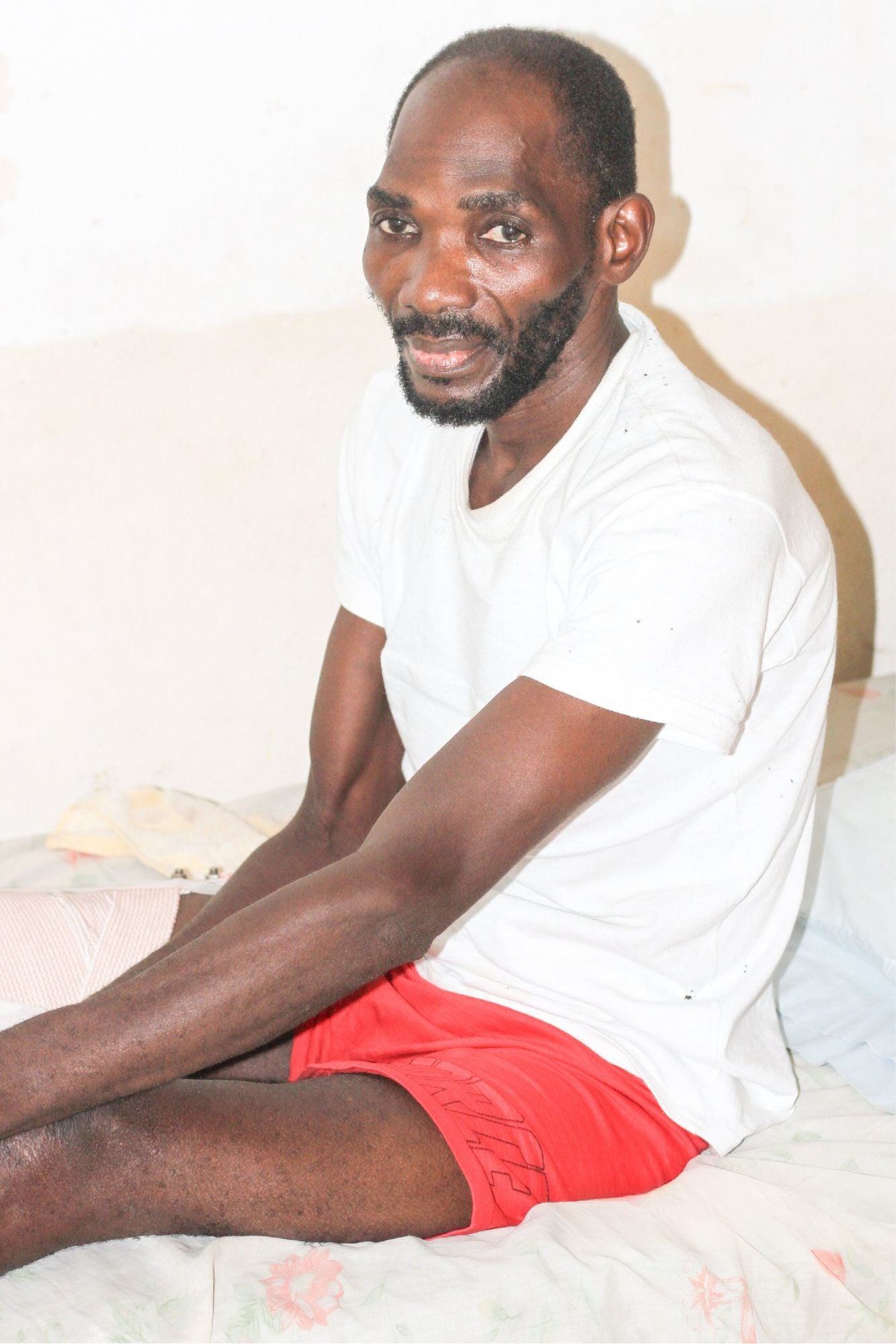 Man sitting on a bed in hospital with wounded leg